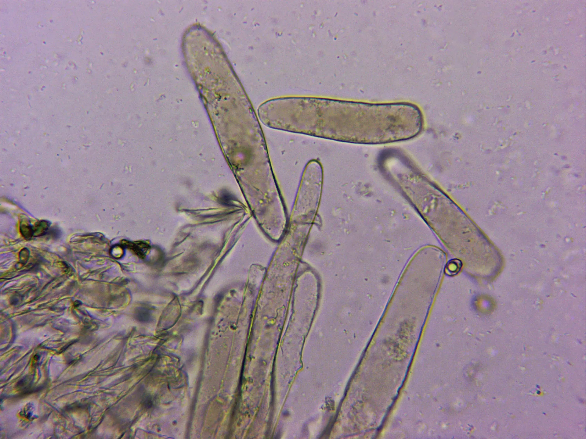 10 - Suprapellis agua x 400 3